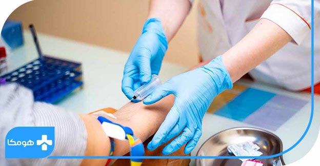 آزمایش Estradiol در منزل